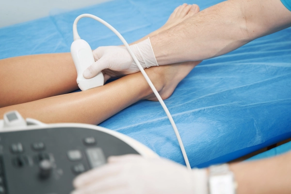 diagnosis-varicoseveinstreatment